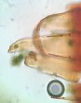 Anacamptodon splachnoides (Froel. ex Brid.) Brid.