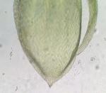 Bryoandersonia illecebra (Hedw.) H. Rob.