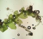 Calypogeia sullivantii Austin
