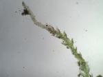 Cephalozia bicuspidata (L.) Dumort.
