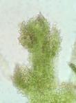 Cephaloziella spinicaulis Doulin