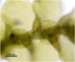 Cheilolejeunea clypeata (Schwein.) W. Ye & R. L. Zhu