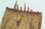 Coscinodon cribrosus (Hedw.) Spruce