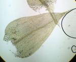 Drepanocladus aduncus (Hedw.) Warnst.