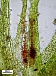 Ephemerum serratum (Schreb. ex Hedw.) Hampe