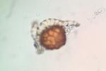 Fossombronia cristula Austin