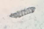 Fossombronia cristula Austin