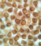 Fossombronia foveolata Lindb.