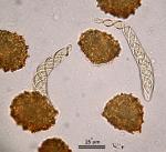 Fossombronia porphyrorhiza (Nees) Prosk.