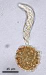 Fossombronia porphyrorhiza (Nees) Prosk.