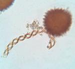 Fossombronia wondraczekii (Corda) Dumort. ex Lindb.