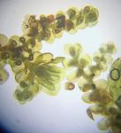 Frullania appalachiana R. M. Schuster