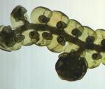 Frullania asagrayana Montagne