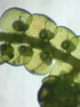 Frullania asagrayana Montagne