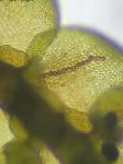 Frullania asagrayana Montagne