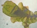 Frullania eboracensis Gottsche ssp. eboracensis