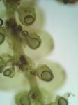 Frullania ericoides (Nees) Mont.