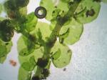 Frullania inflata Gottsche