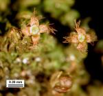 Frullania inflata Gottsche