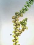 Frullania kunzei Lehmann & Lindberg