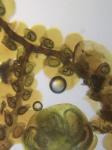 Frullania kunzei Lehmann & Lindberg