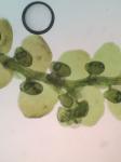 Frullania kunzei Lehmann & Lindberg