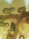 Frullania kunzei Lehmann & Lindberg