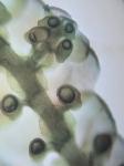 Frullania kunzei Lehmann & Lindberg
