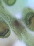 Frullania kunzei Lehmann & Lindberg