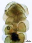 Frullania oakesiana Sullivant ssp. oakesiana