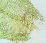 Homalotheciella subcapillata (Hedw.) Broth.