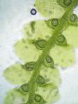Lejeunea lamacerina (Steph.) Schiffn. ssp. gemminata R.M. Schust.