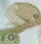 Lejeunea ruthii (A. Evans) R.M. Schust.