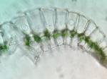 Leucobryum glaucum (Hedw.) Ångstr