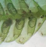 Cheilolejeunea conchifolia (A. Evans) W. Ye & R.L. Zhu    