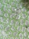 Cheilolejeunea conchifolia (A. Evans) W. Ye & R.L. Zhu    