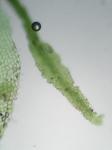 Metzgeria crassipilis (Lindb.) A. Evans