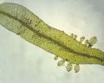 Metzgeria furcata (L.) Corda