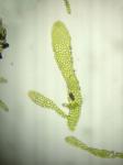 Metzgeria myriopoda Lindberg