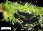 Metzgeria myriopoda Lindberg