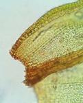 Orthotrichum ohioense Sullivant & Lesquereux