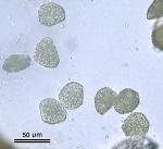Phaeoceros laevis (L.) Prosk.