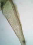 Philonotis fontana (Hedw.) Brid. var. fontana