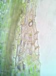 Philonotis fontana (Hedw.) Brid. var. fontana