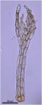 Philonotis uncinata (Schwagr.) Bridel