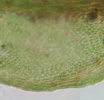 Platylomella lescurii (Sull.) A. L. Andrews