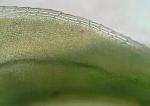 Pleurochaete luteola (Besch.) Ther.
