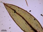 Ptychostomum creberrimum (Taylor) J.R. Spence & H.P. Ramsay