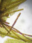 Ptychostomum pseudotriquetrum (Hedw.) J.R. Spence & H.P. Ramsay ex Holyoak & N. Pedersen