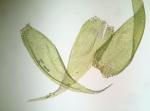 Pylaisiadelpha tenuirostris (Bruch & Schimp. ex Sull.) W.R. Buck